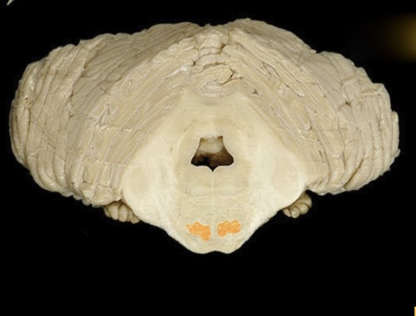 <p>Name this structure</p>