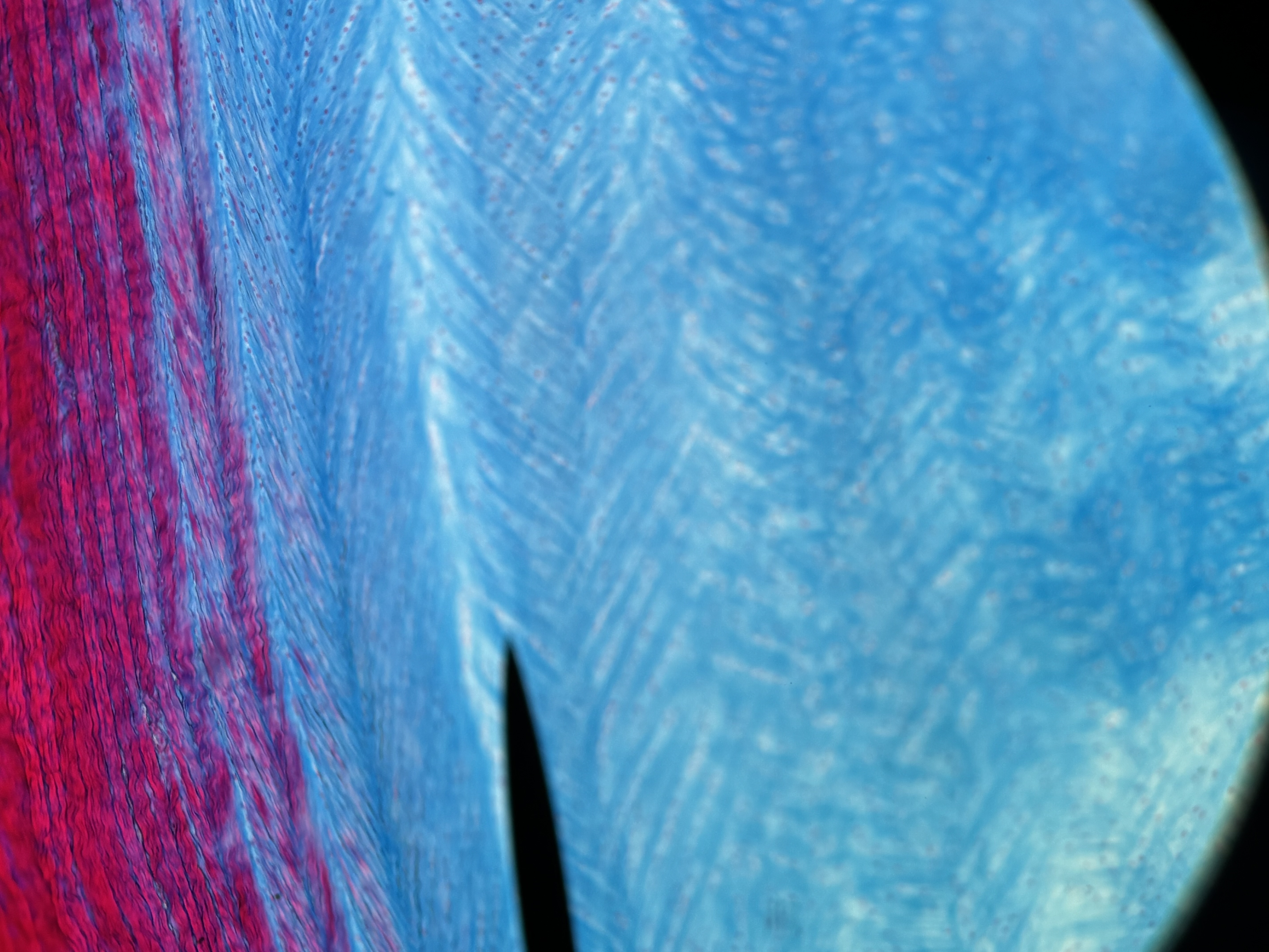 <p><span>Fibrocartilage</span></p>