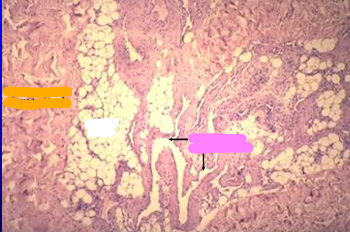 <p>Identify the structure:</p><p>Specie:</p><p>Orange:</p><p>White:</p><p>Pink:</p>
