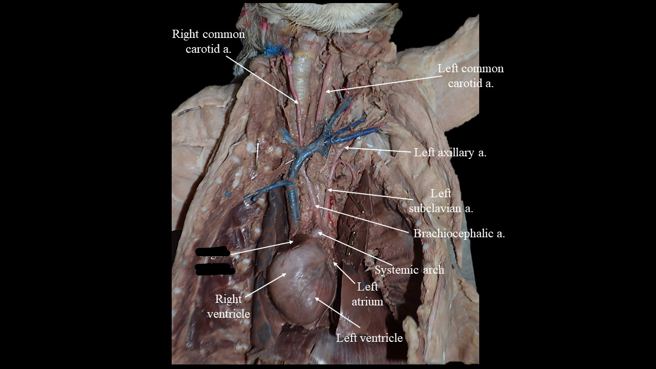 <p>receives deoxygenated blood from body and pumps it into right ventricle</p>