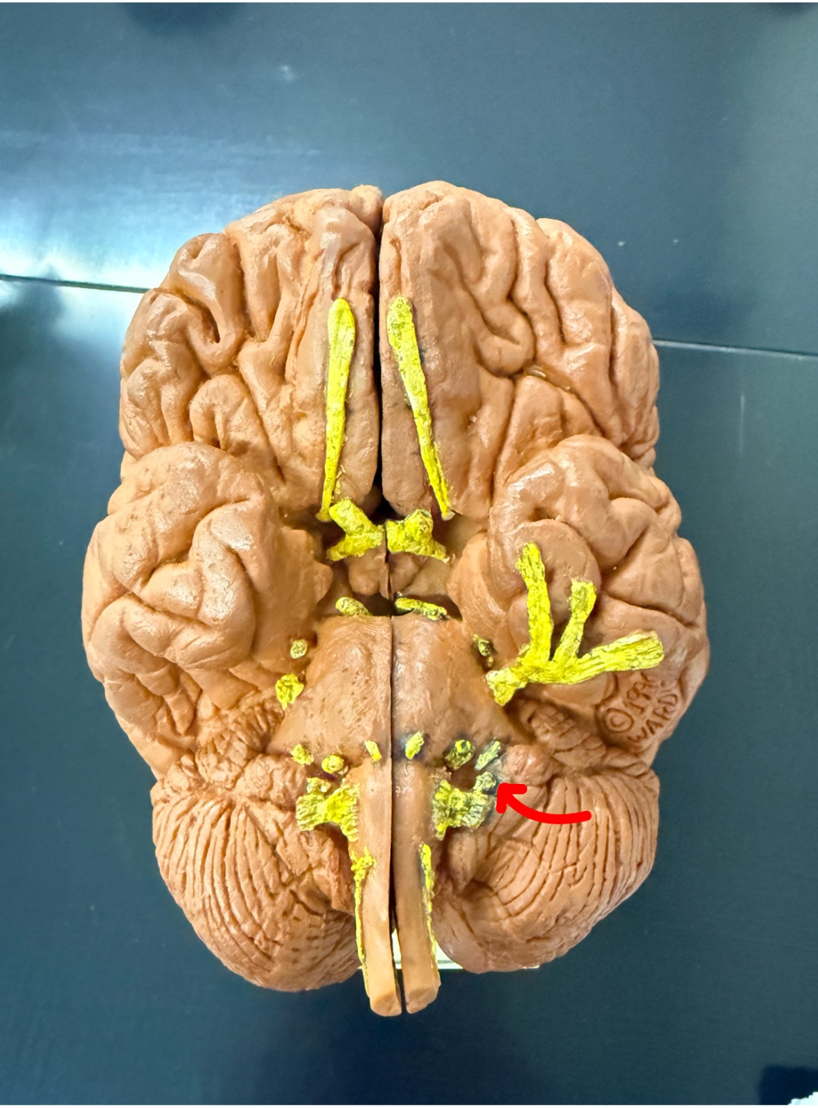 <p>Name the cranial nerve on the brain model</p>