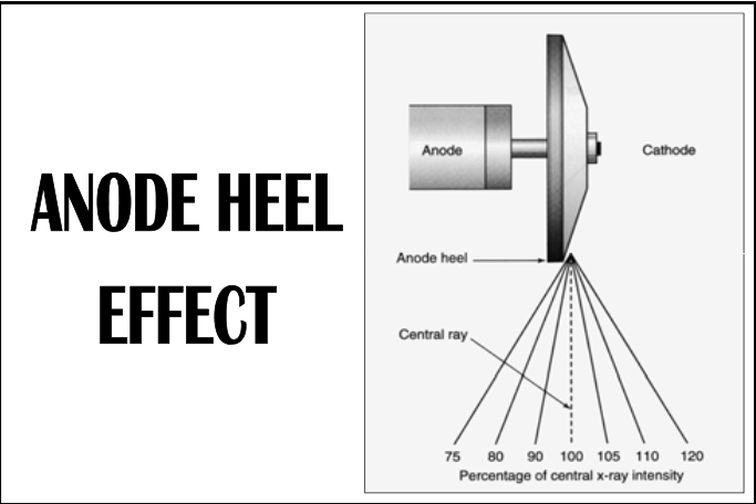 <p><span><strong>[...]</strong></span>: x-ray beam intensity is not uniform &nbsp;</p><ul><li><p>X-ray intensity is 100% in the <span>center</span>, called the <span>central ray</span></p></li><li><p>Towards the anode, x-ray intensity <span>decreases</span></p></li><li><p>Towards the cathode, x-ray intensity <span>increases</span></p></li></ul><p></p>
