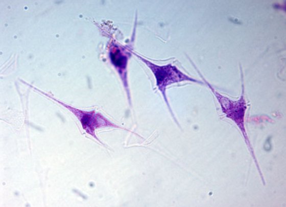 <p>dinoflagellates</p>