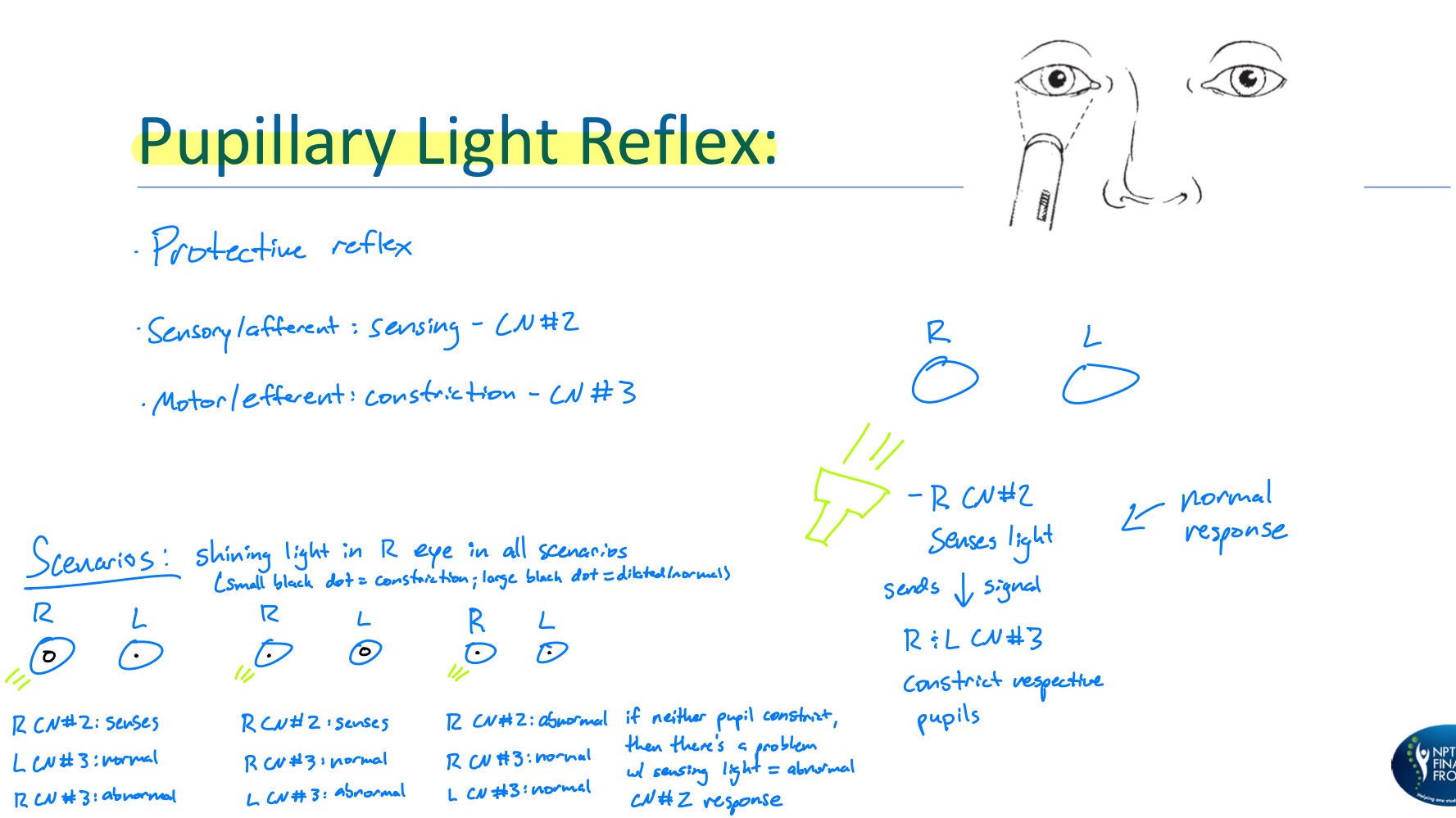 <p>Protective reflex</p><p>Sensory/afferent: sensing light - CN II</p><p>Motor/efferent: constriction - CN III</p>
