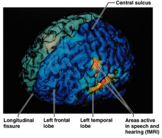 <ul><li><p class="">Functional magnetic resonance imaging (fMRI)</p></li><li><p class="">Measures brain activity via blood flow</p></li><li><p class="">Cerebral cortex of person speaking &amp; hearing</p></li><li><p class="">Activity in<strong> frontal lobe</strong> (speaking)</p></li><li><p class="">Activity in<strong> temporal lobe</strong> (hearing)</p></li></ul><p></p>