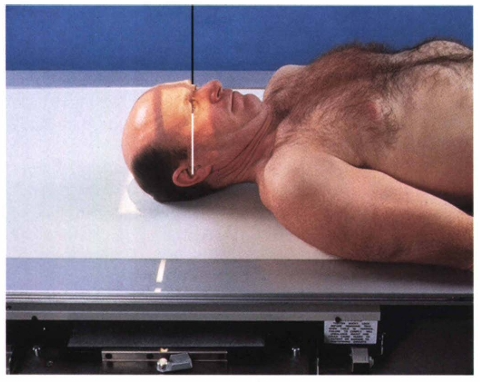 <p><span style="color: oklch(0.3039 0.04 213.68);">The AP skull projection is used when the patient cannot tolerate PA positioning; the central ray is ___________________ or directed to the nasion at an angle of ______________ degrees _______________.</span></p>