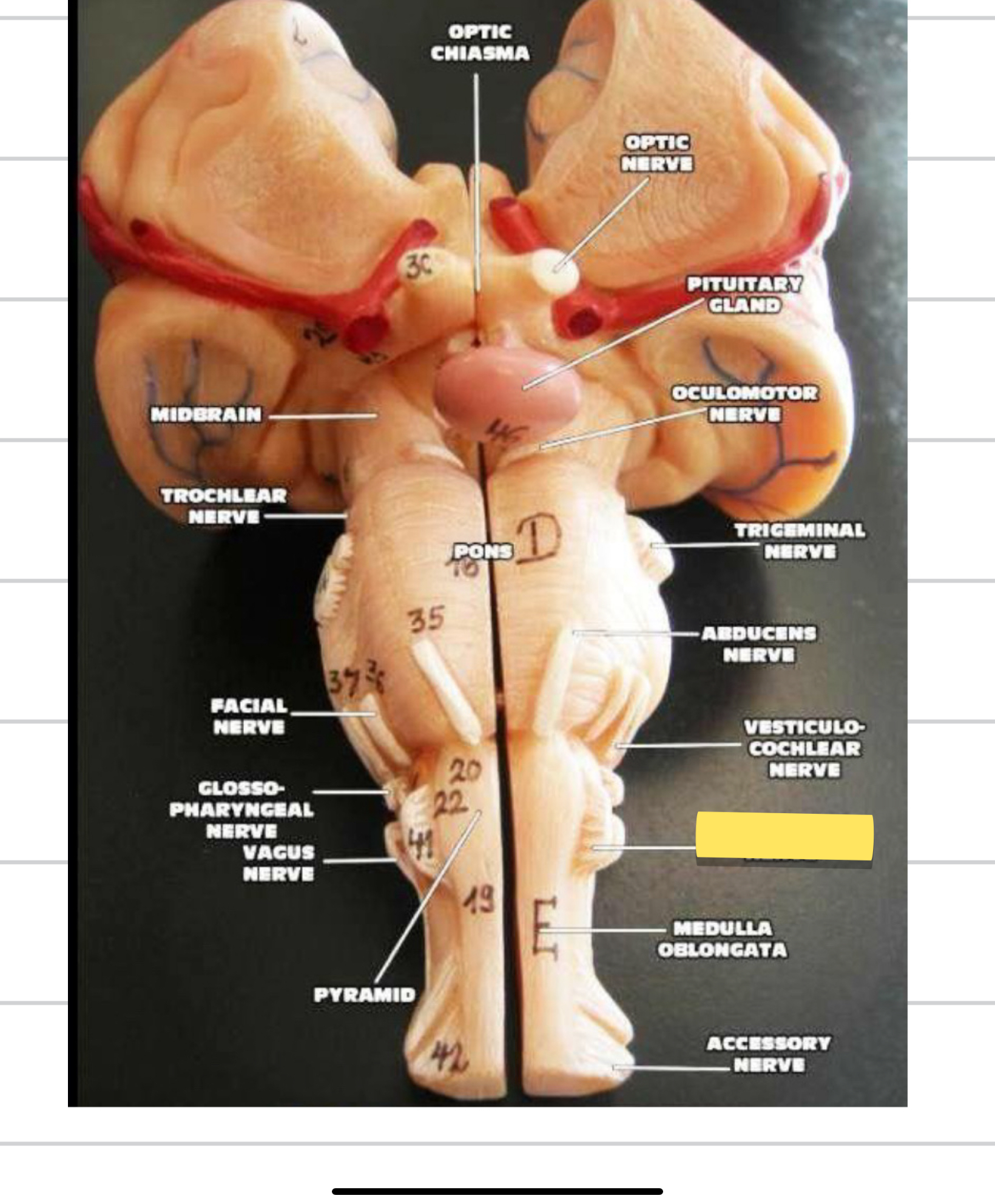 <p>Name this cranial nerve&nbsp;</p>