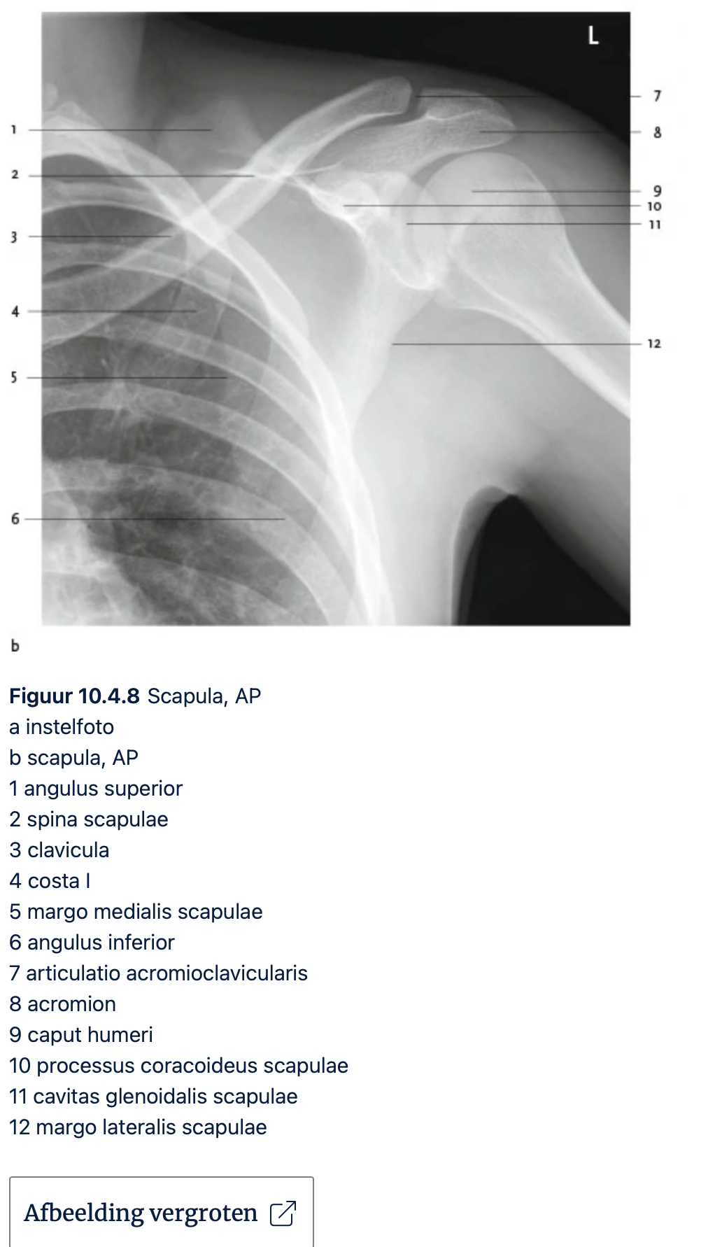 <p><span>angulus inferior</span></p>