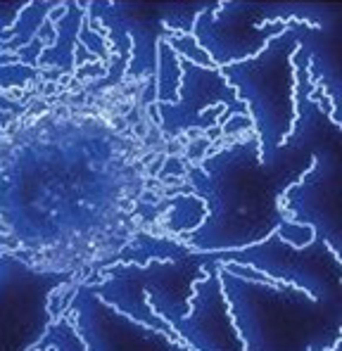 <p>Dark-field microscopy</p>