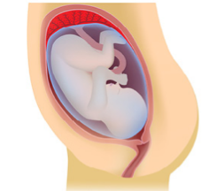 <p>What kind of placenta is shown?</p>
