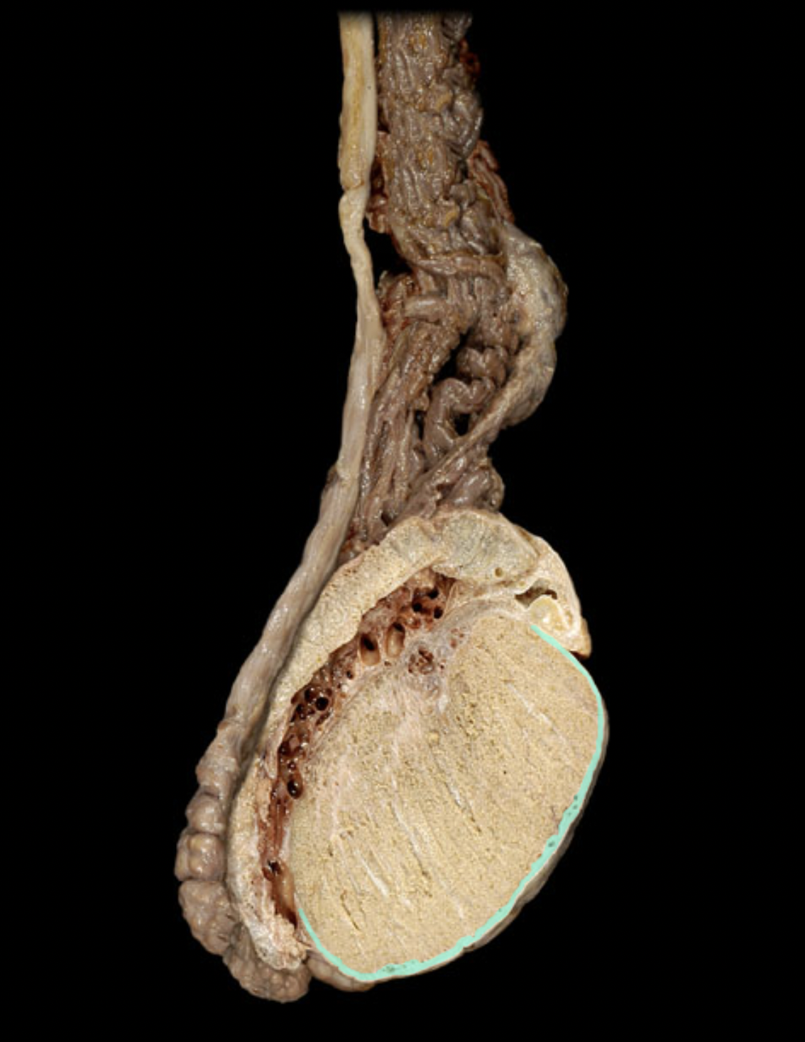 <p>What structure is shown?</p>