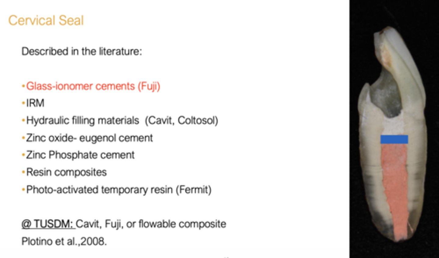 <p>- Cavit</p><p>- Fuji</p><p>- Flowable composite</p>