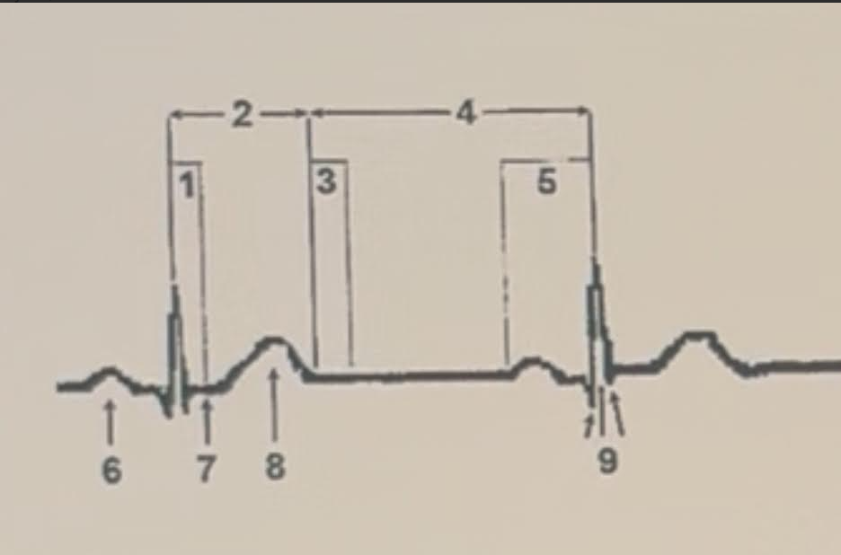 <p>Identify this image. </p>