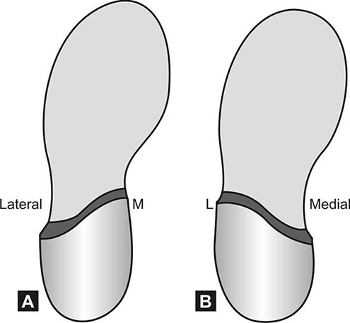 <p>produce inversion of the forefoot.</p>