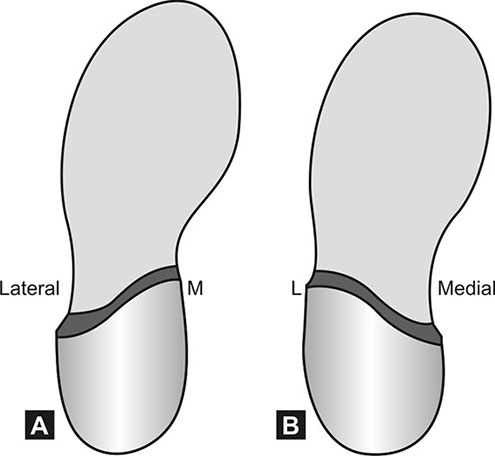 <p>produce inversion of the forefoot. </p>