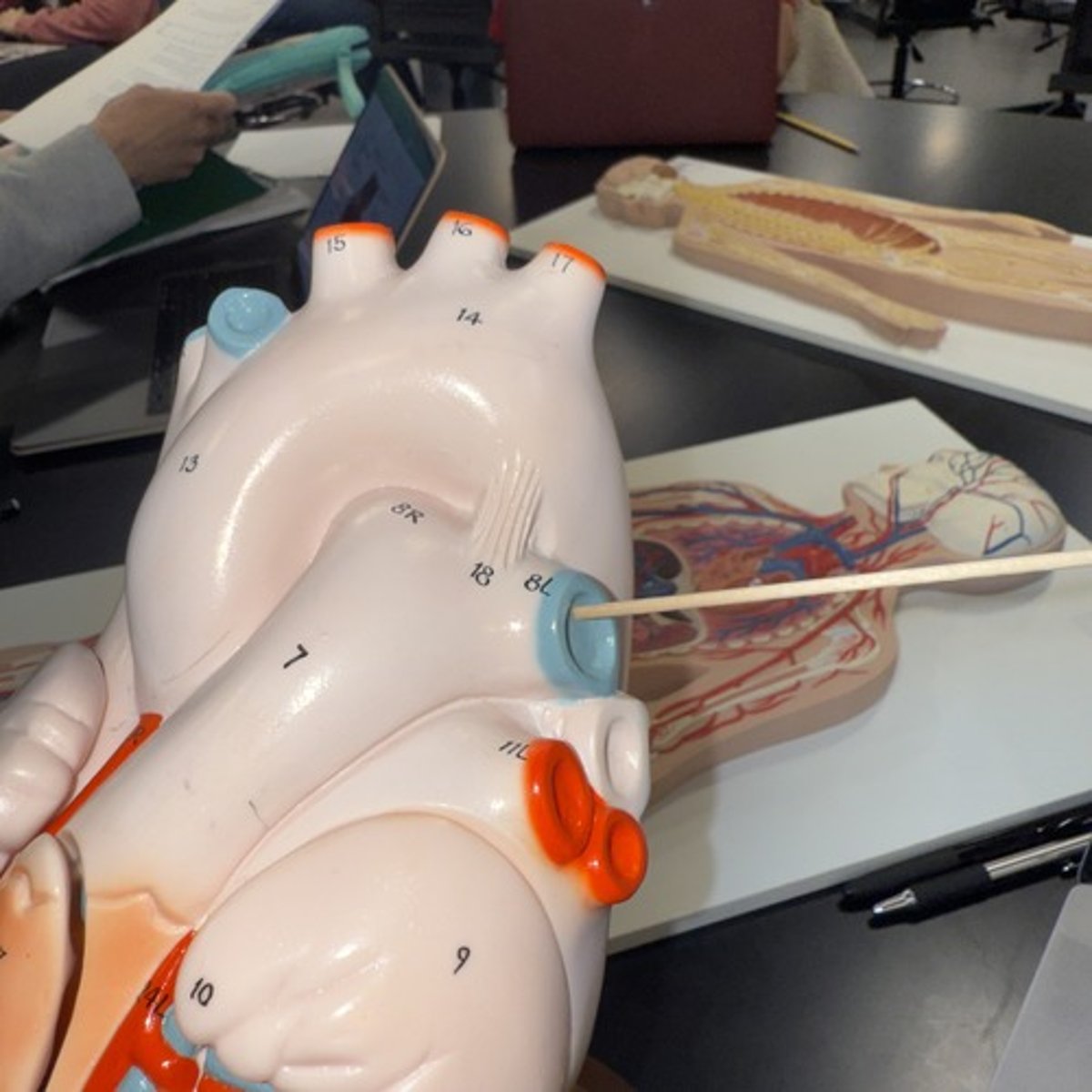 <p>Identify the structure.</p>