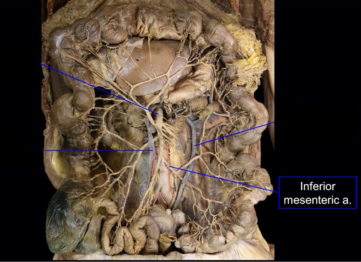 <p>abdominal aorta<br>(highlighted: inferior mesenteric artery)</p>