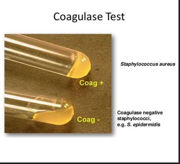 <p>Coagulase Test</p>