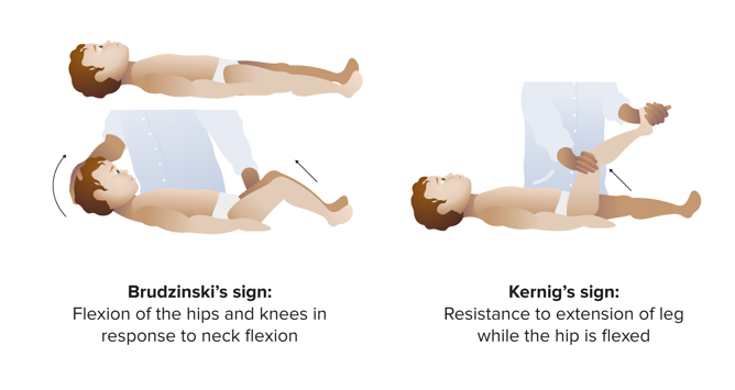 <p>-Brudzinski’s teken → wanneer de nek wordt gebogen in ruglig zullen de heupen en knieën zich ook buigen.</p><p>-Kernig’s teken → bij plooien van de benen en heup zal er worden tegengewrongen en hebben ze veel pijn.</p>