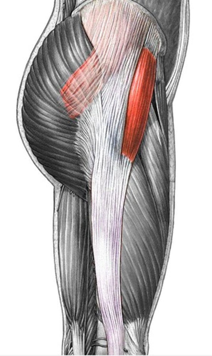 <p>superior gluteal nerve</p>