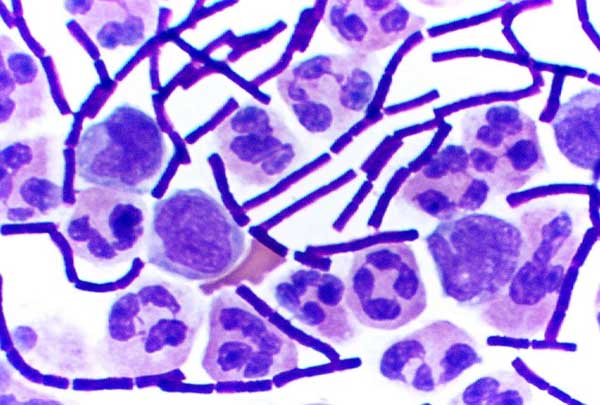 <p>Gram positive or gram negative bacteria?</p>