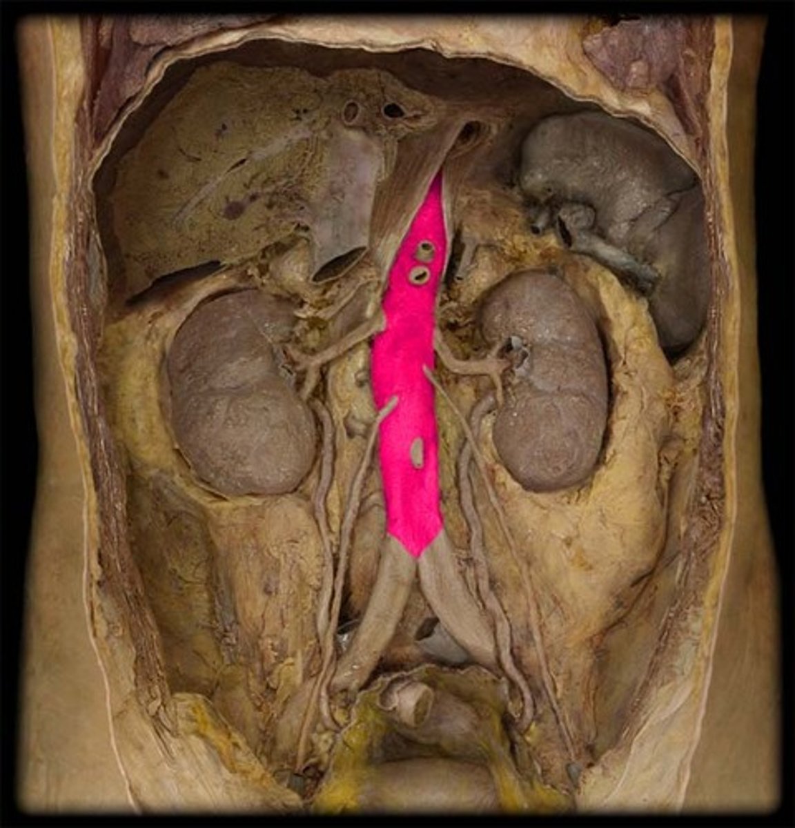 <p>continuation of the thoracic aorta that runs through the abdominal cavity</p>