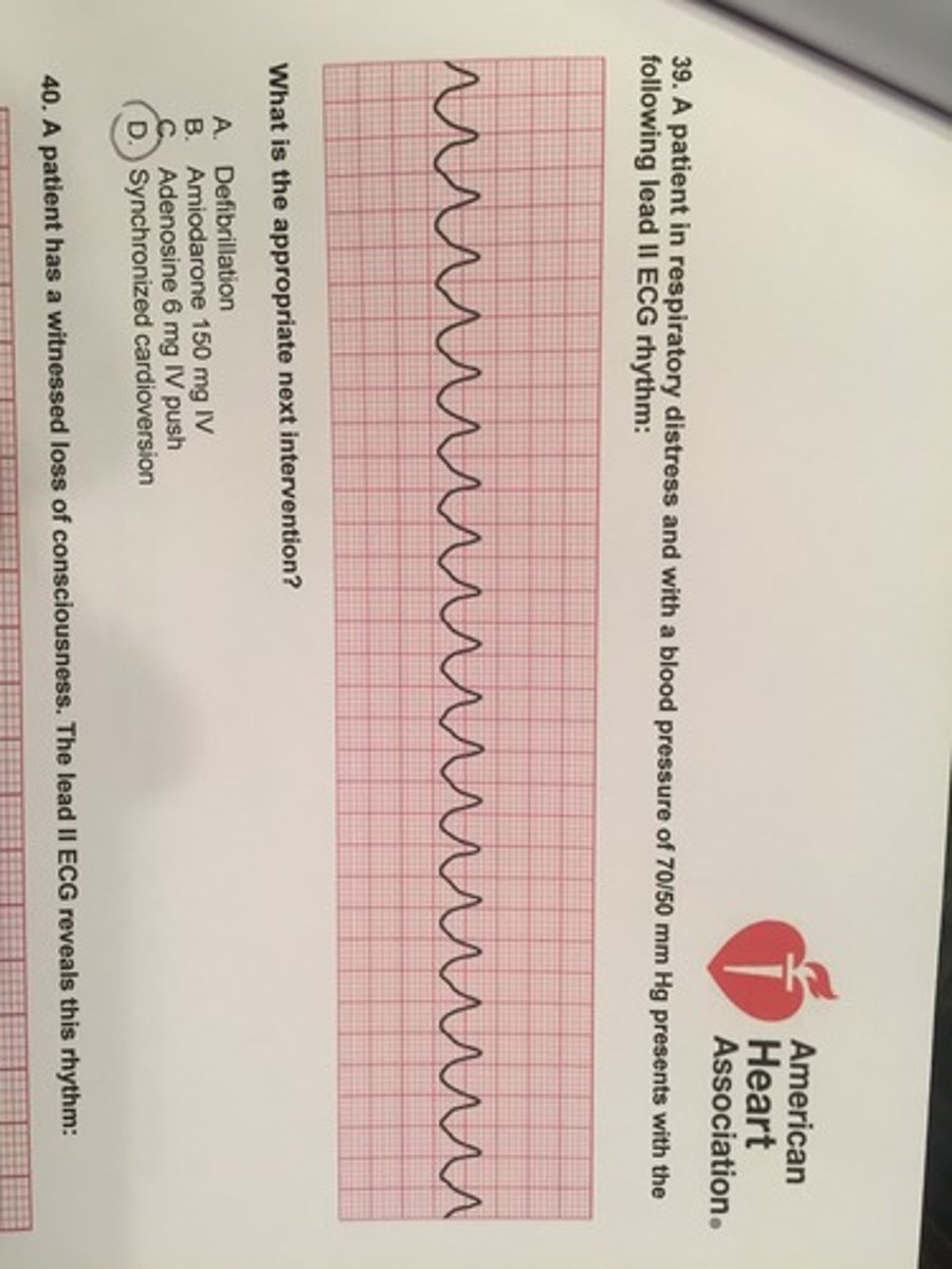<p>Synchronized cardioversion</p>