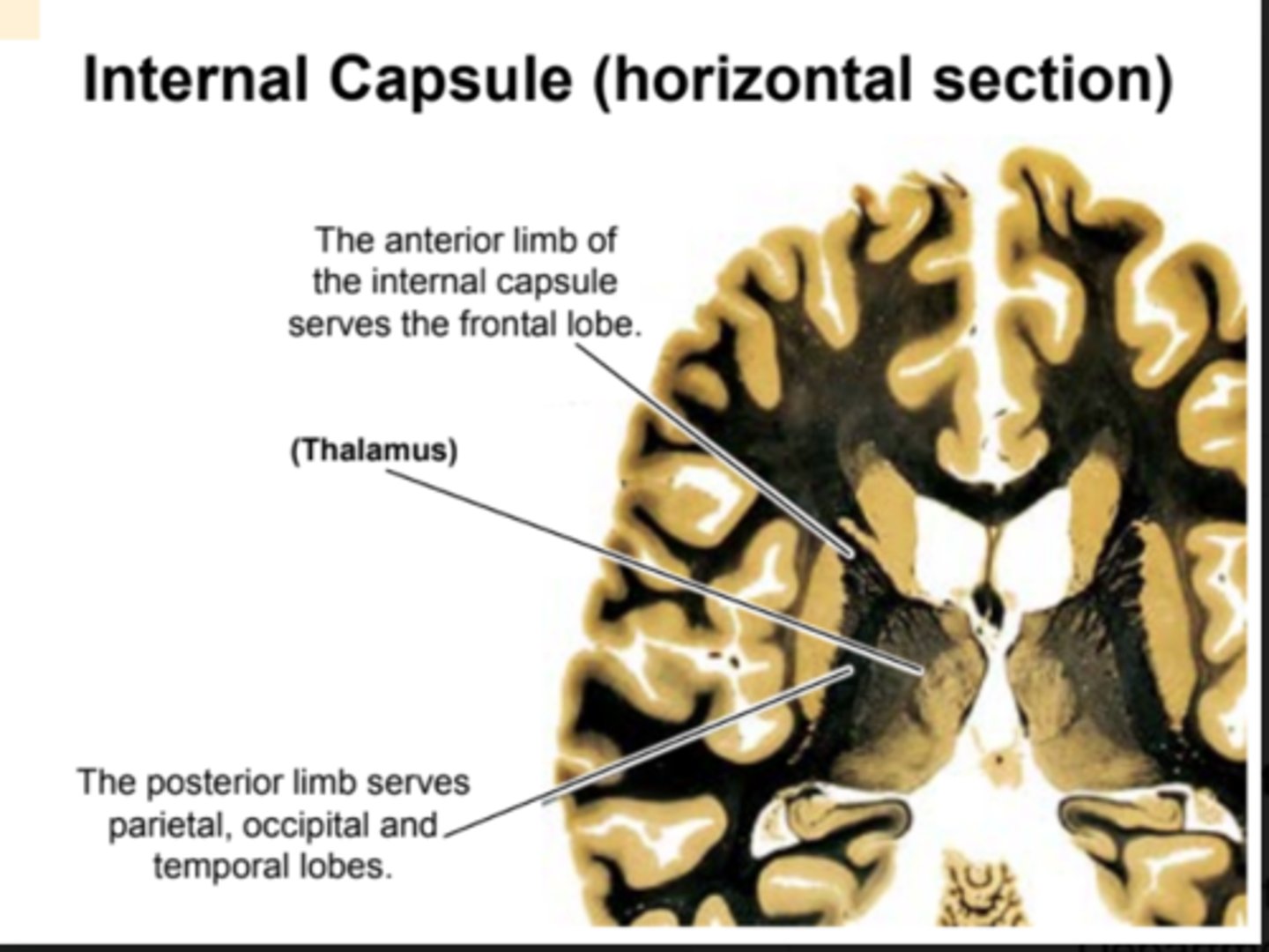 <p>A superhighway of axons entering and exiting the cortex<br>- axons from neurons in thalamus ascend to the cortex via the internal capsule<br>- Axons from neurons in the cortex descend to thalamus via the internal capsule<br>- Axons projecting to the brain stem or spinal cord also follow the internal capsule and pass just lateral to the thalamus</p>
