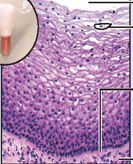 <p>stratified squamous epithelium (non keratinized)</p>