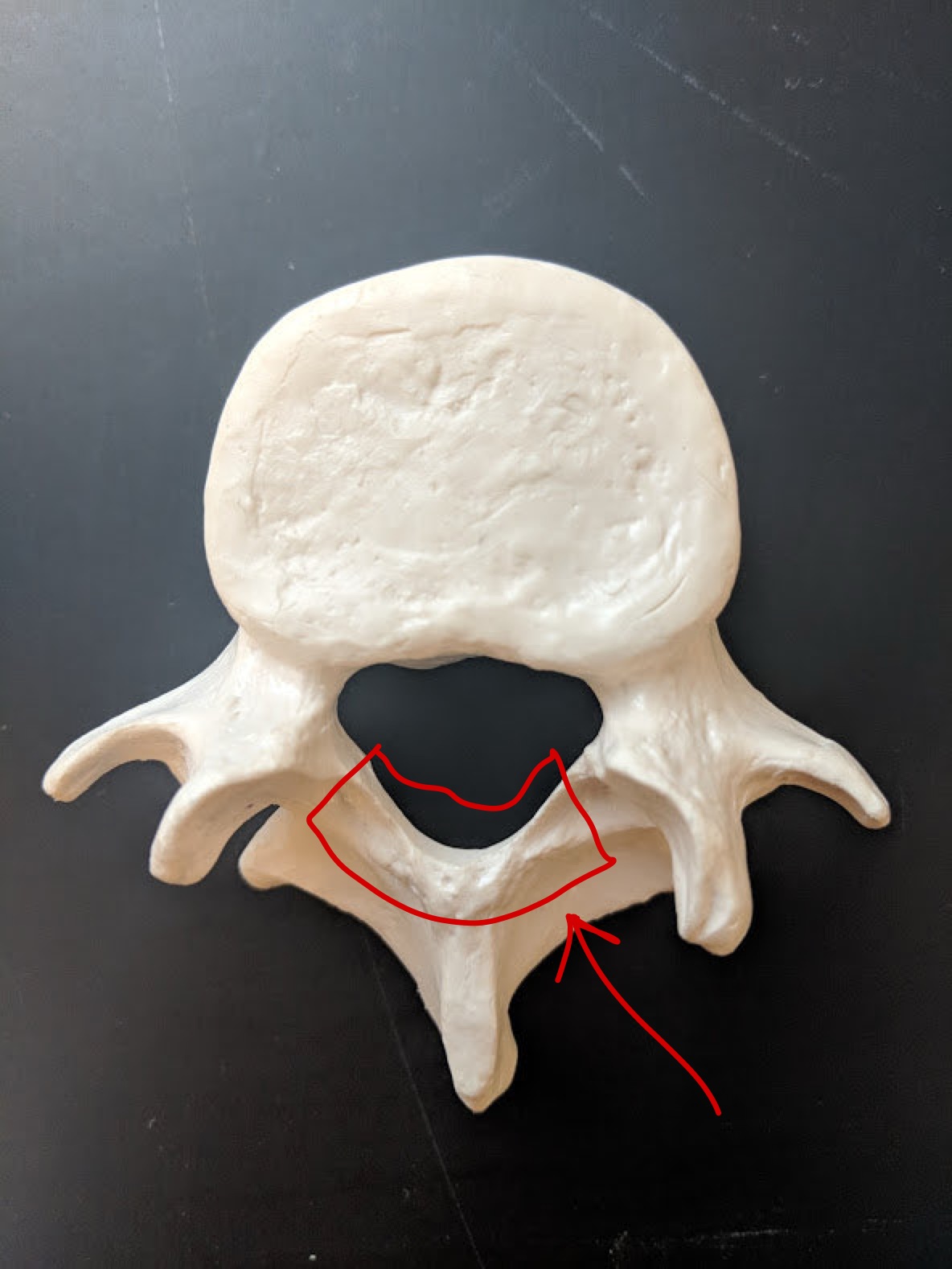 <p>Name this structure</p>