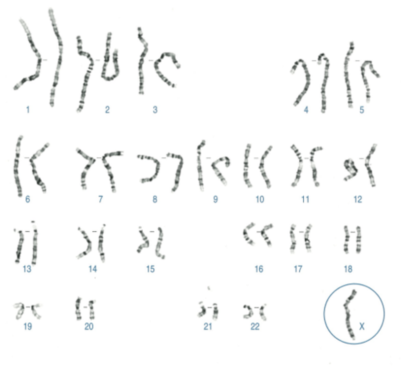<p>Name:</p><p>- Correctly written karyotype</p><p>- Common name</p><p>- Scientific name</p><p>- One distinguishing clinical feature</p><p>- Definition of this feature if not obvious</p>