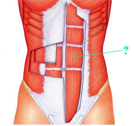 <p><span>Identify the indicated muscle.</span></p>