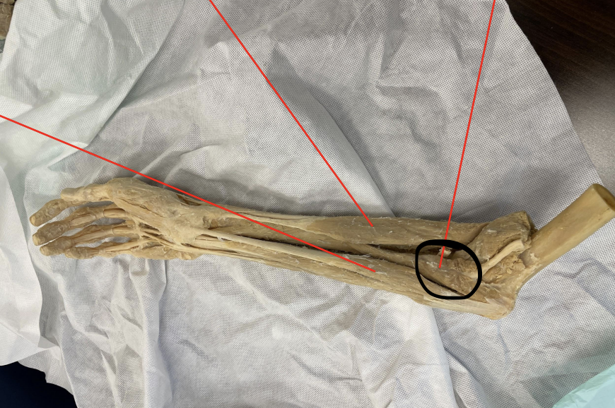 <p>identify + state origin, insertion, action, innervation of marked structure</p>