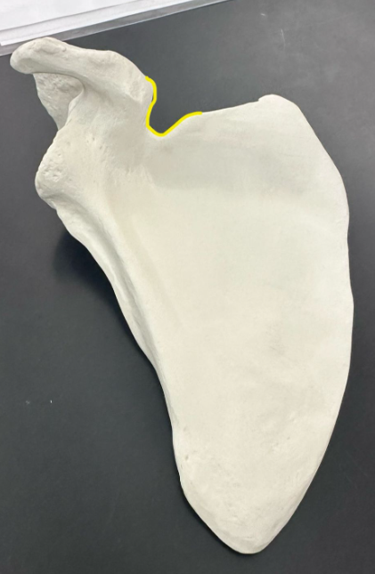 <p>What is outlined in yellow?</p>