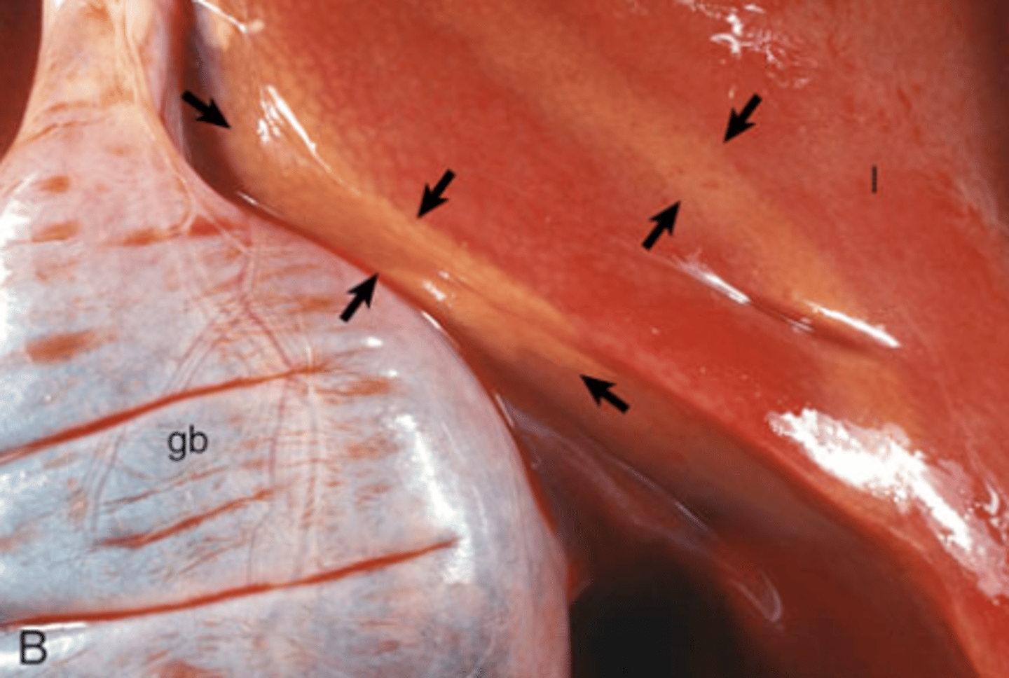 <p>What type of imbibition is shown in this image?</p><p>Hemoglobin or Bile?</p>