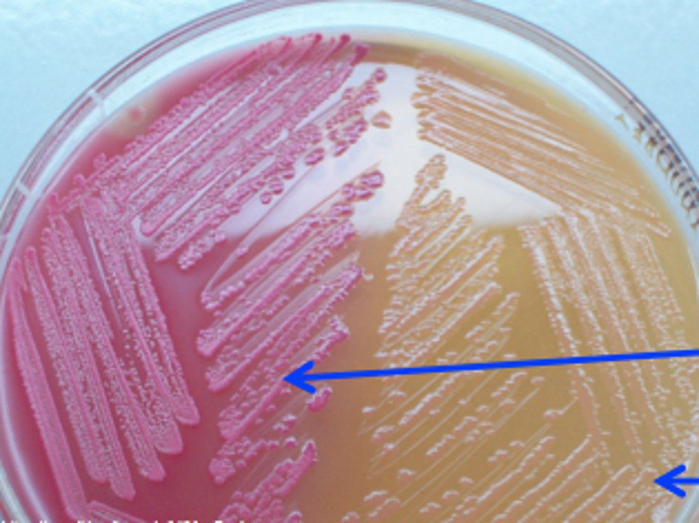 <p>What type of media is this (right)?</p>