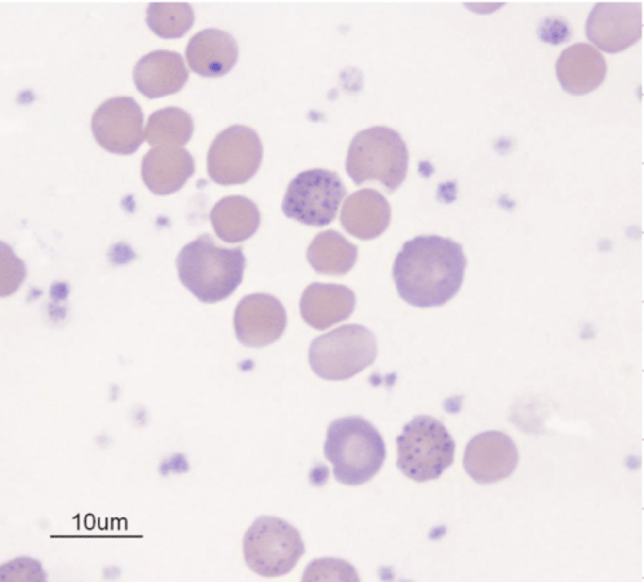 <p>is this anemia regenerative or non regenerative? why?</p>