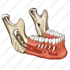 <p>main part of mandible with teeth</p>