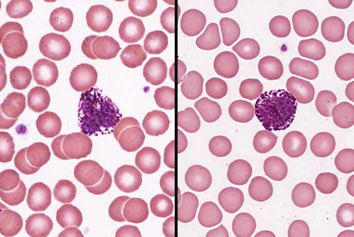 <p>-less than 1%</p><p>-large abundant, violet granules (obscure S-shaped nucleus)</p><p>-increased numbers in chickenpox, sinusitis, diabetes</p><p>-secrete histamine &amp; heparin</p>