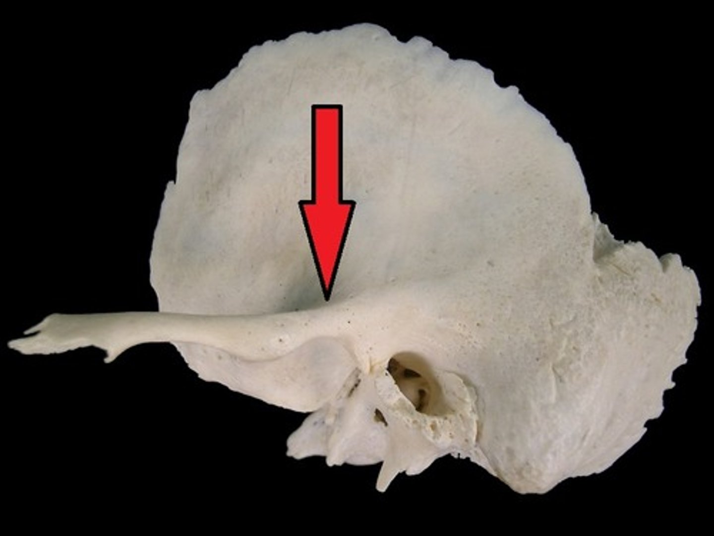 <p>superior root of the zygomatic process, runs horizontally above EAM, <mark data-color="yellow" style="background-color: yellow; color: inherit">farther forward than supramastoid crest</mark></p>