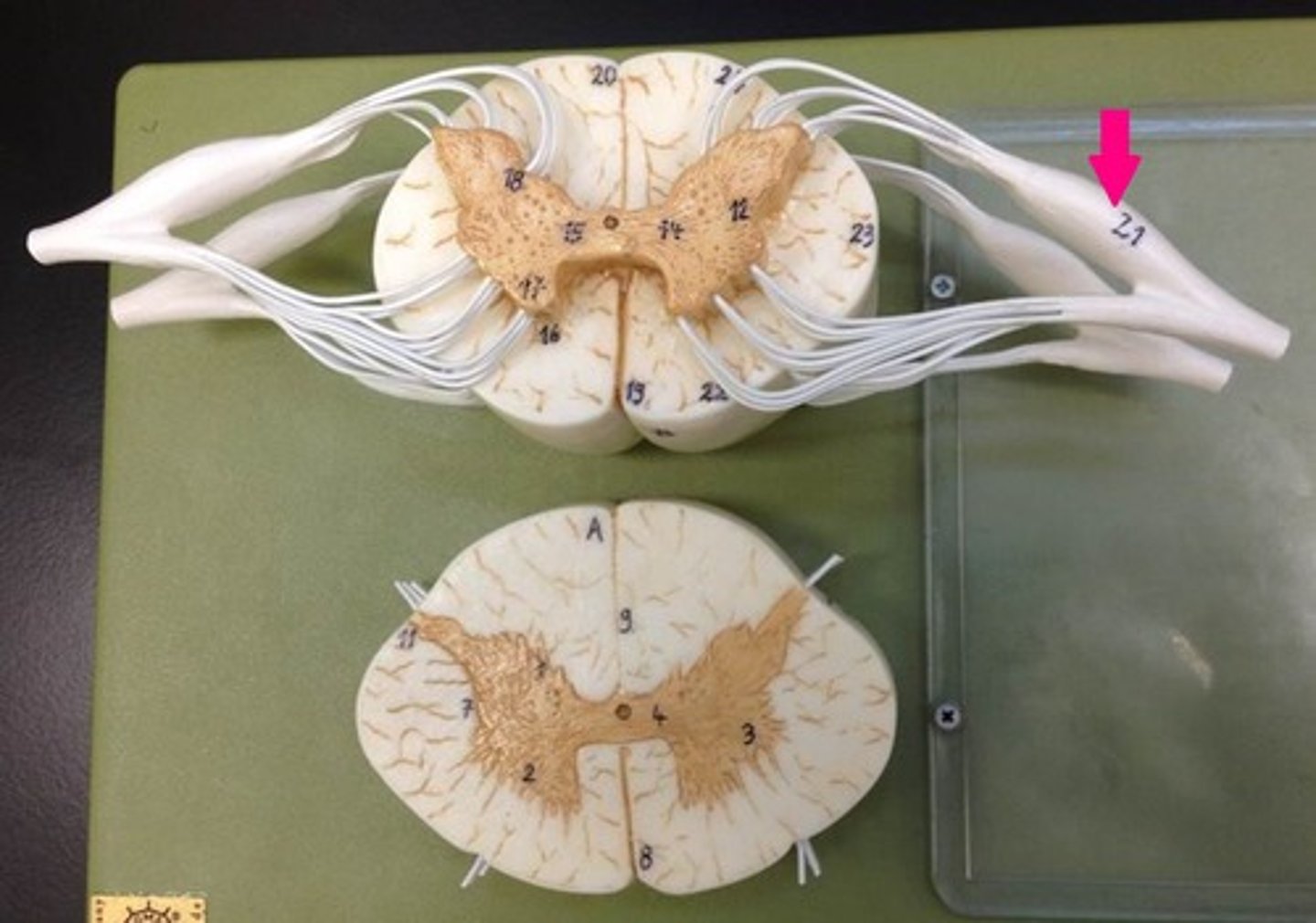 <p>Thick spot before the dorsal root, filled with cell bodies of sensory neurons</p>