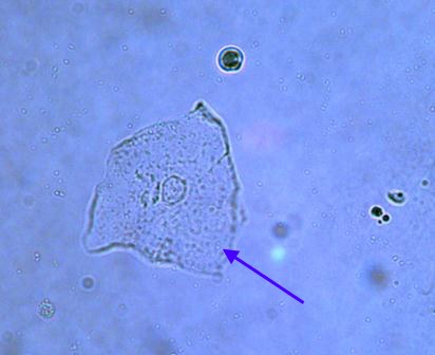 <p>Derived from the distal urethra, vagina, vulva, or prepuce; not significant; flat, thin cells with homogenous appearance</p>