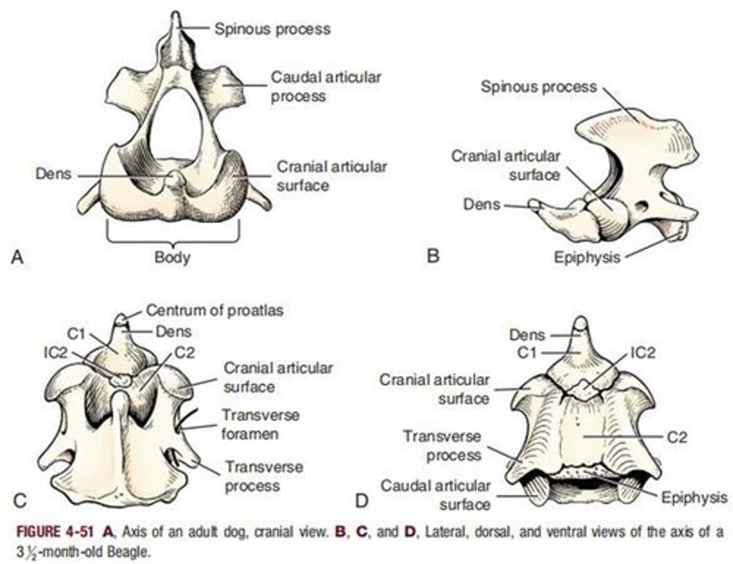 <p>Second cervical vertebra, features dens process.</p>