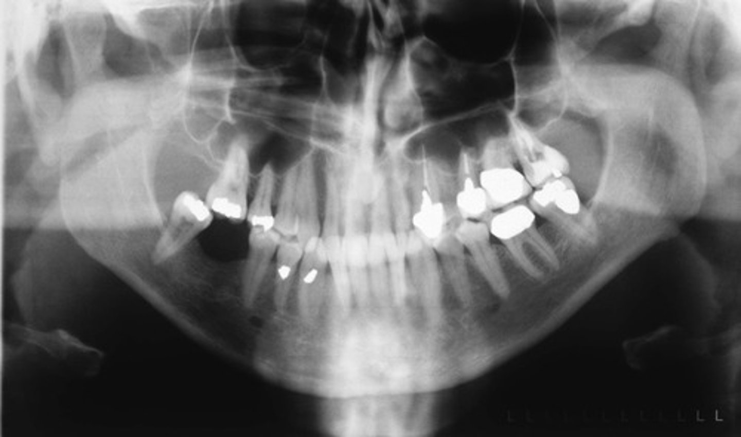 <p>Identify type of error</p>