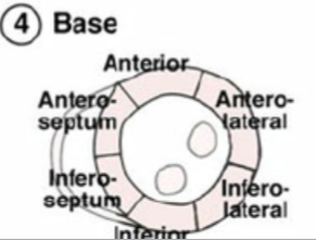 <p>Base or top</p>