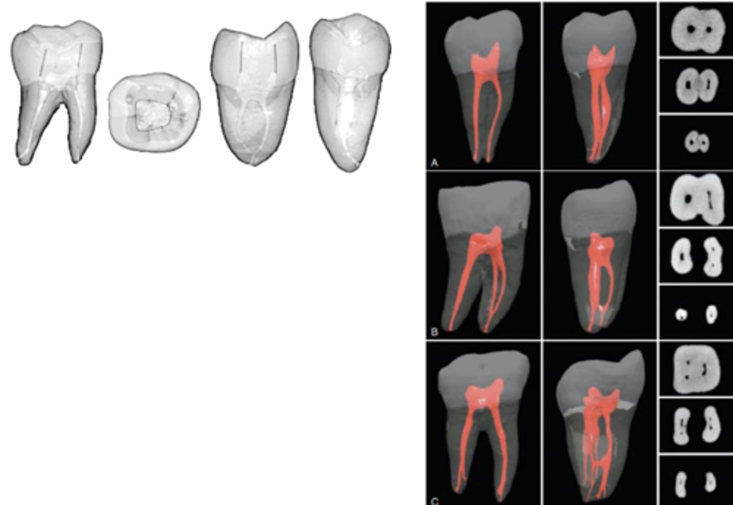 <p>mesial</p>