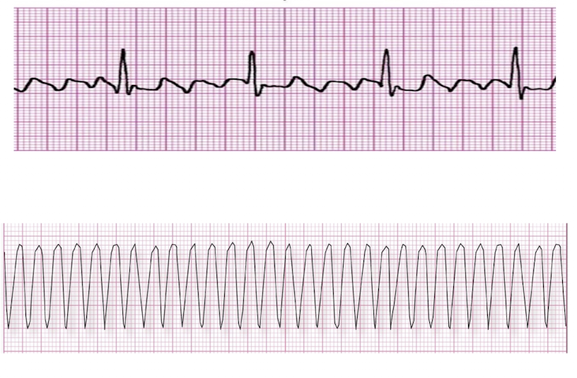 <p>Guess the Strips</p>