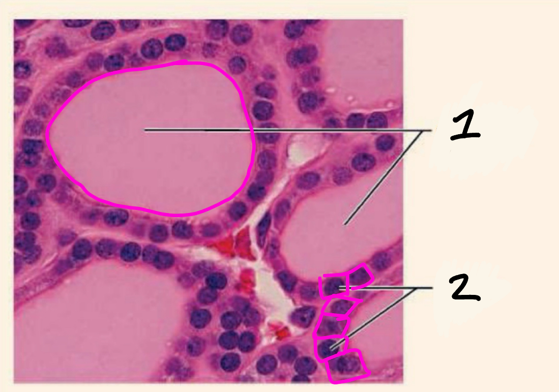 <p>What gland is this? Identify 1 &amp; 2</p>