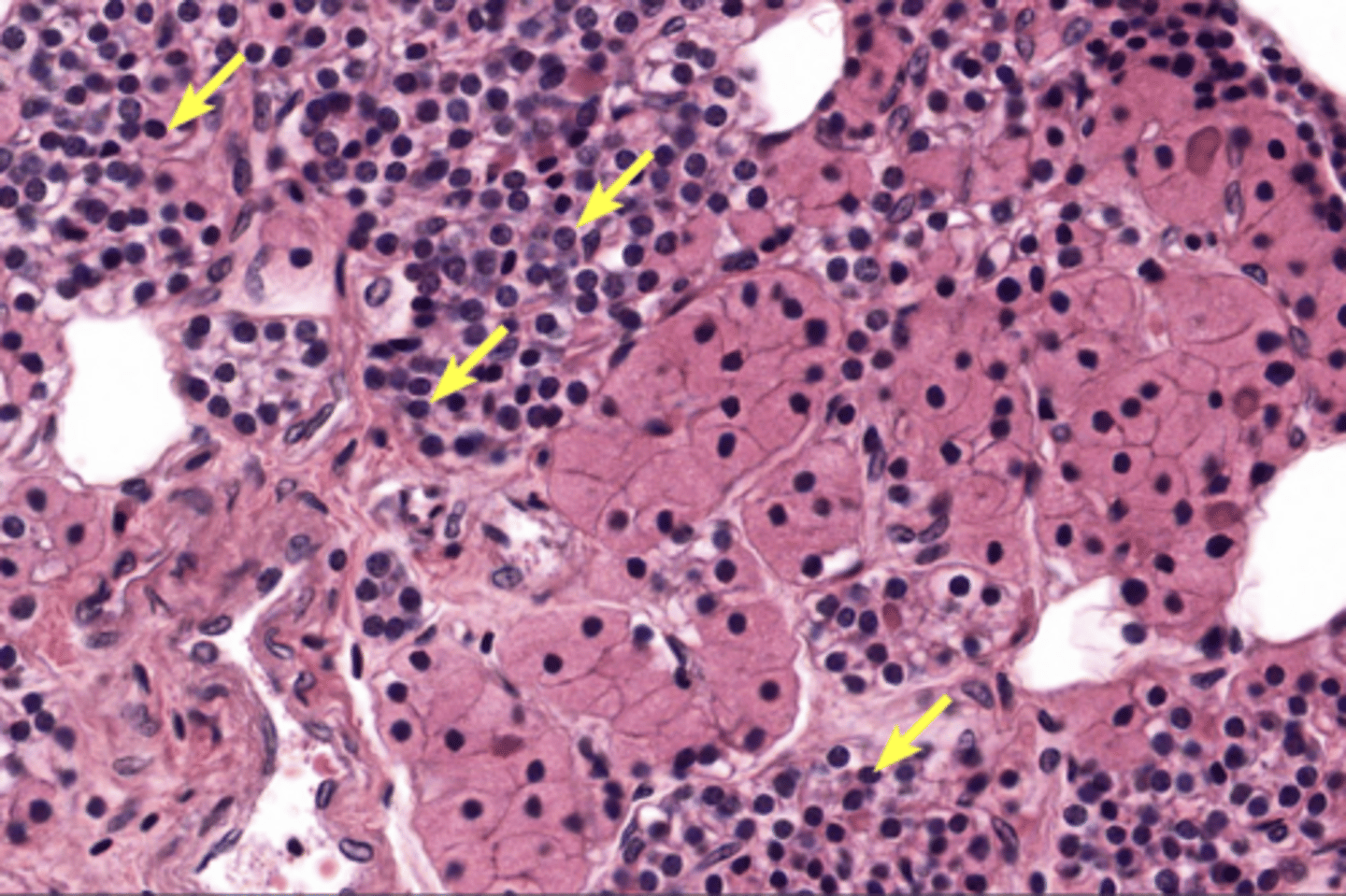 <p>In parathyroid gland</p>