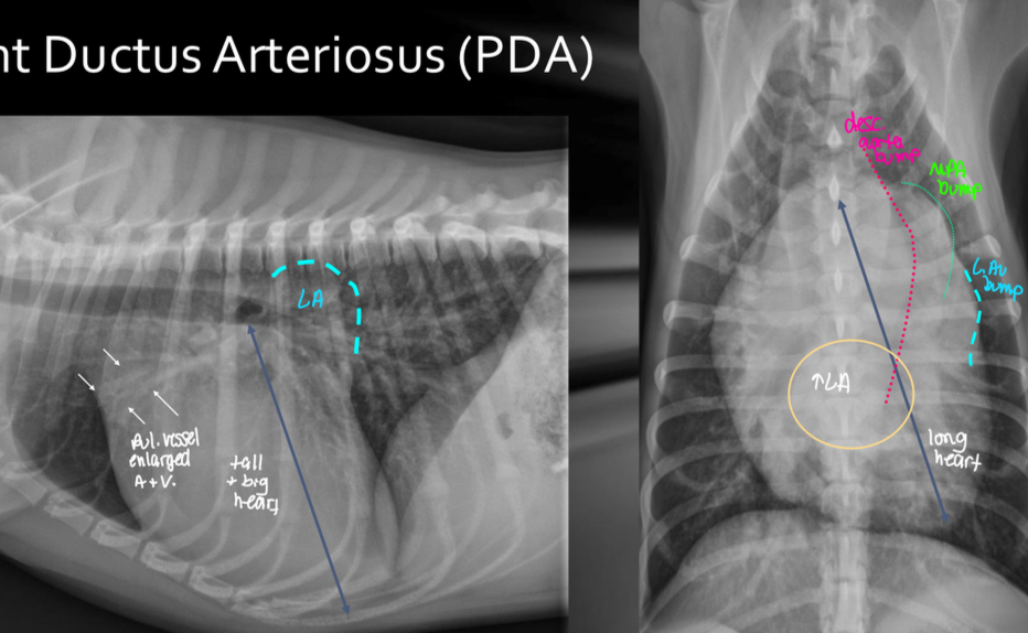 <p>-BIG LVE, VOLUME OVERLOAD</p><p>-triple bump sign on VD (Prox desc. Aorta, MPA, L.Au)</p><p>-normal to large pulmonary vessels (hyperperfusion)</p><p>±LHF</p>